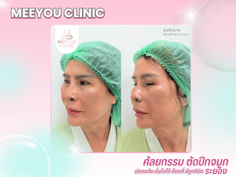 มียูคลินิก ระยอง บริการศัลยกรรมและปรับรูปหน้าครบวงจร